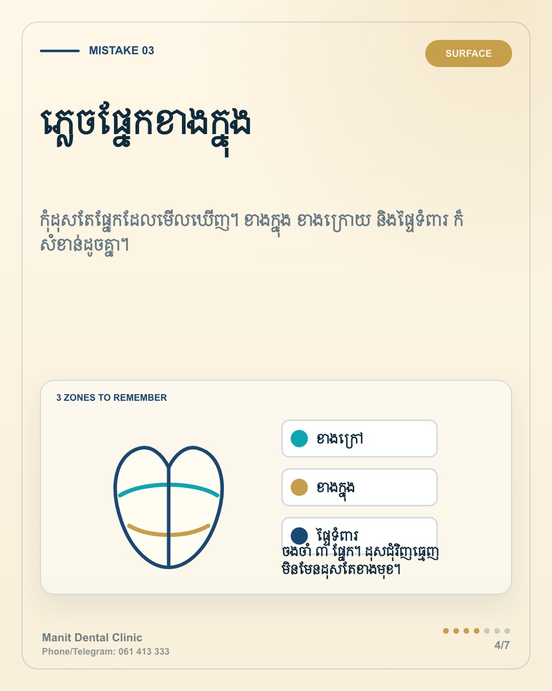 រូបភាព Manit បង្ហាញផ្ទៃធ្មេញដែលមនុស្សជាច្រើនតែងដុសរំលង