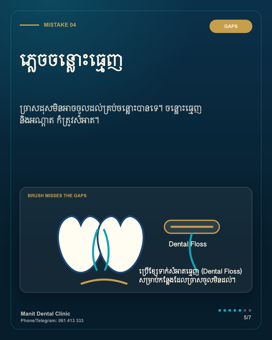 រូបភាព Manit អំពីការសម្អាតចន្លោះធ្មេញ និងអណ្តាត