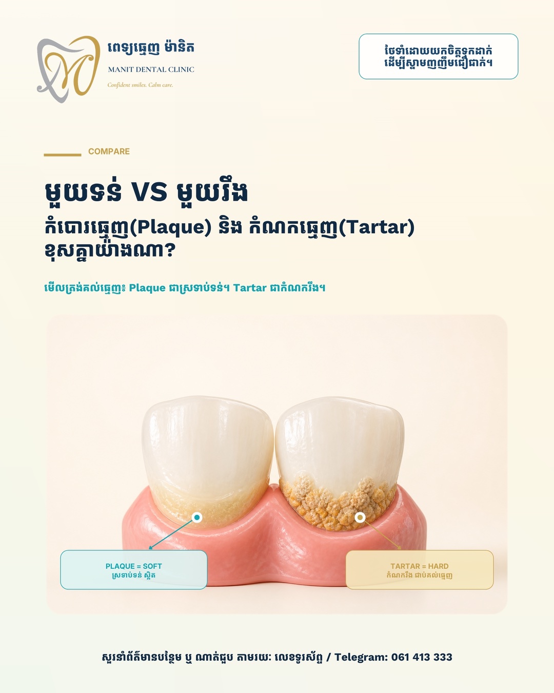 គម្របអត្ថបទ Manit ប្រៀបធៀប Plaque និង Tartar