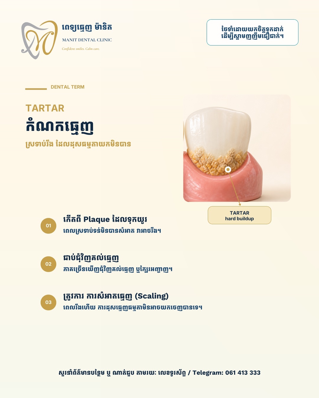 រូបភាព Manit ពន្យល់ថា Tartar ជាអ្វី