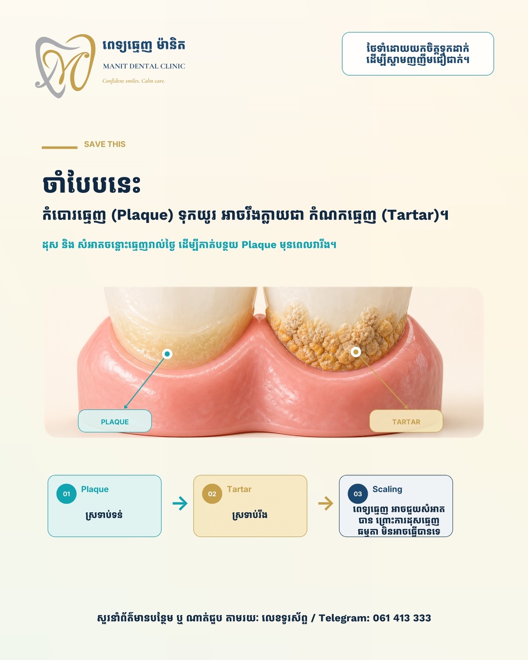 រូបភាពសង្ខេបអំពី Plaque, Tartar និង Scaling